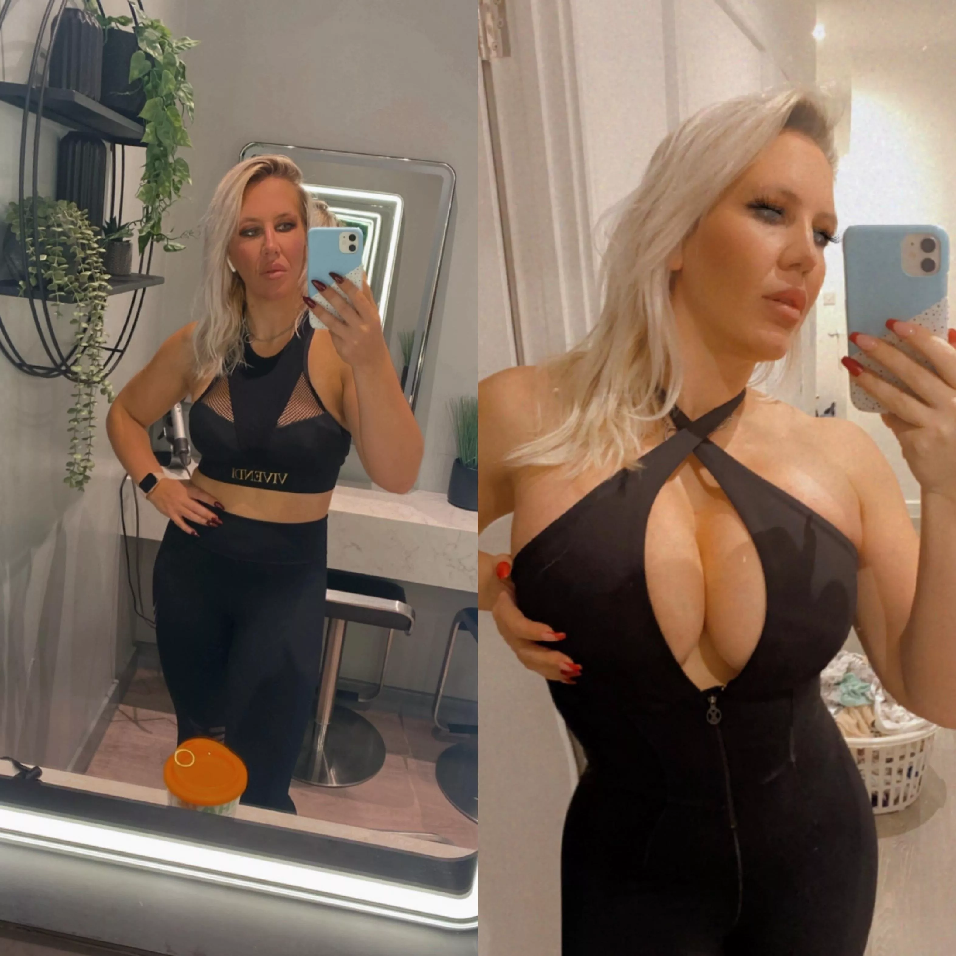Before and after my implants.