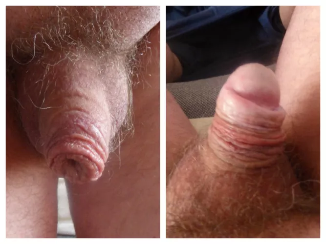 On / Off or Circumcised and Restored