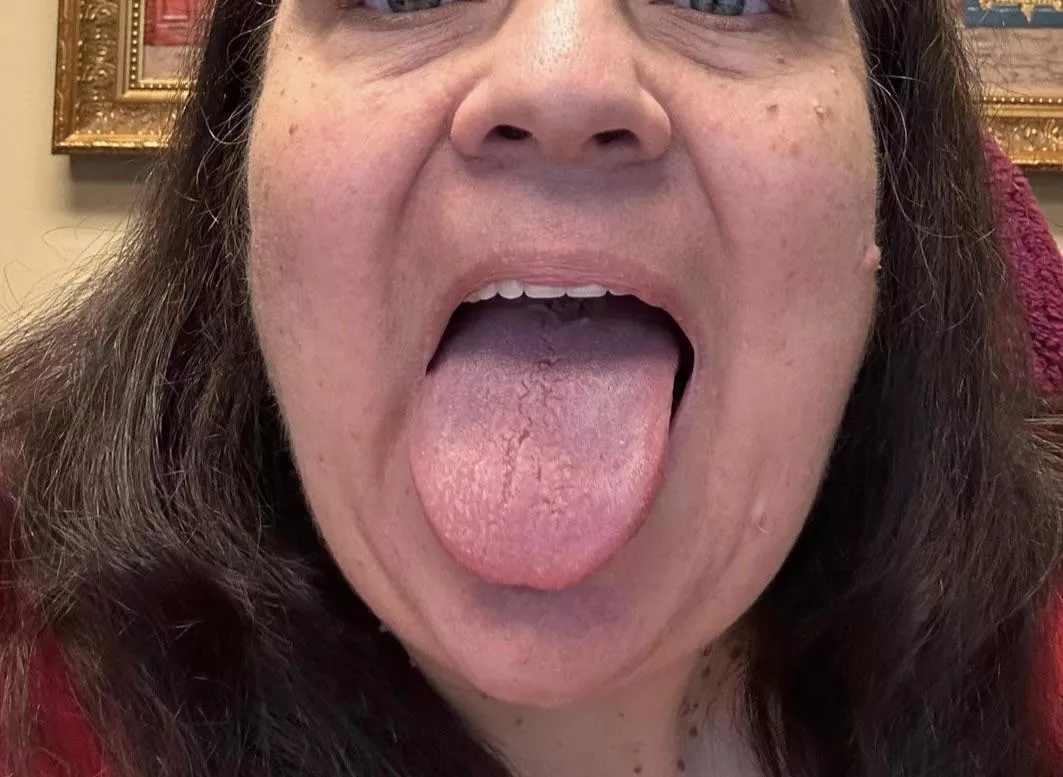 What would you do with this mouth?