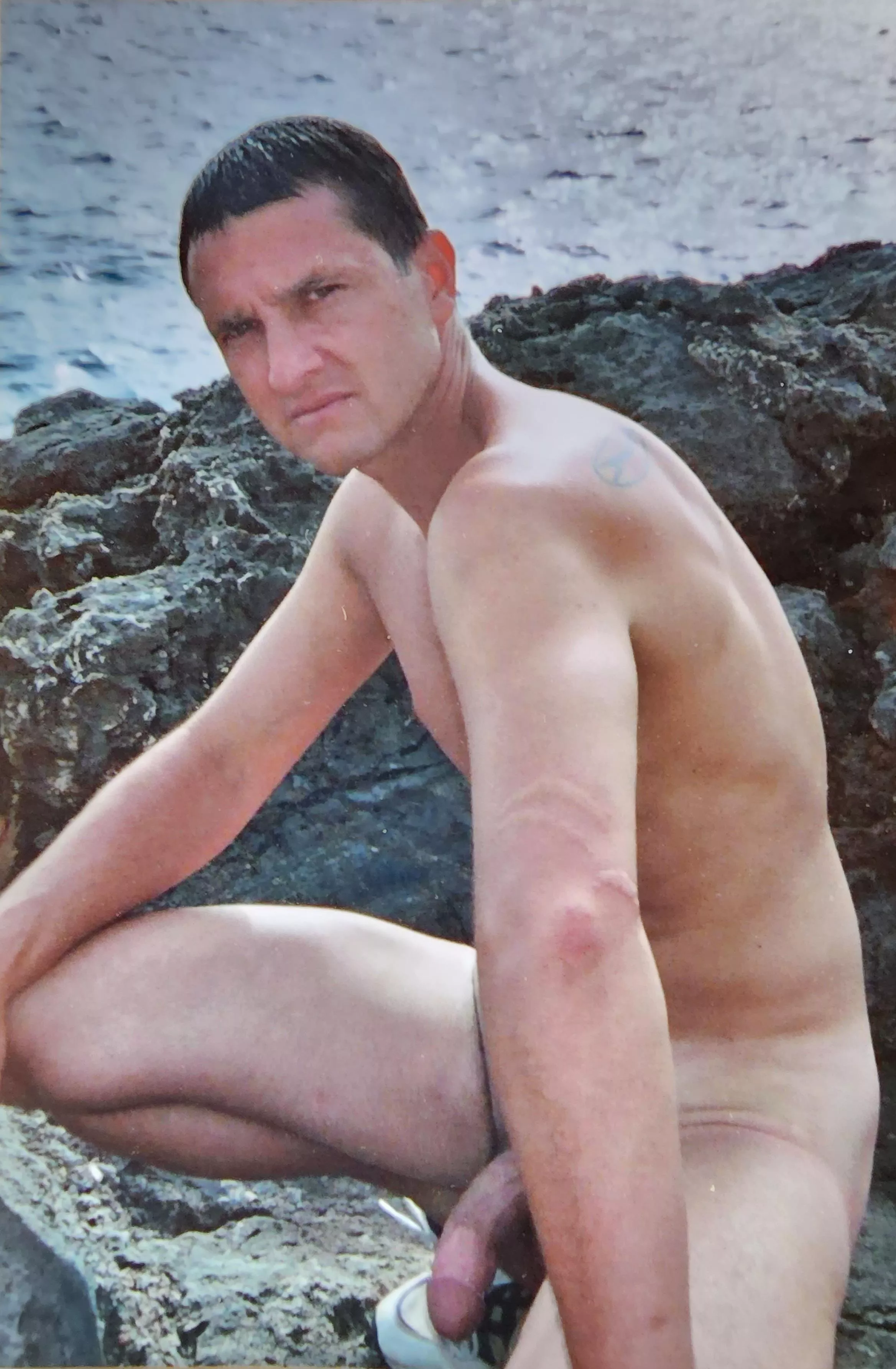 After getting entangled with a jellyfish a crowd of people gathered to check the damage done