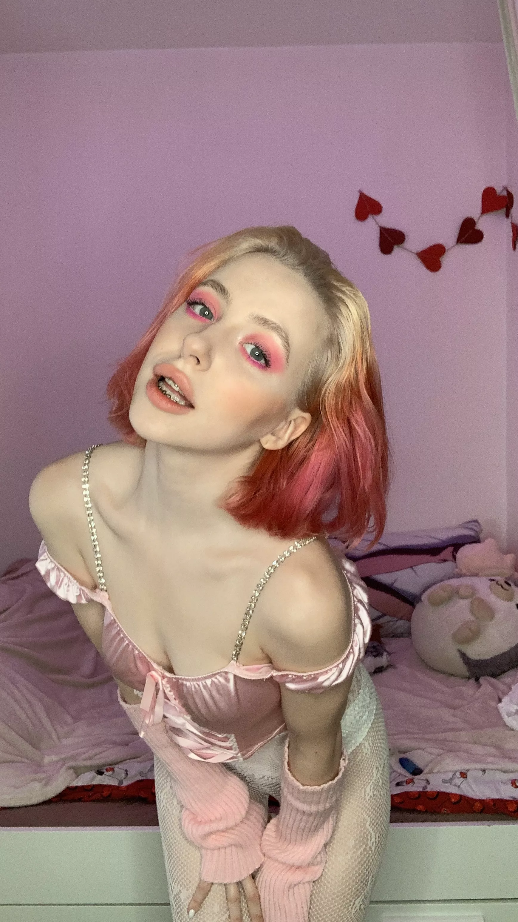 braces are sooo cute