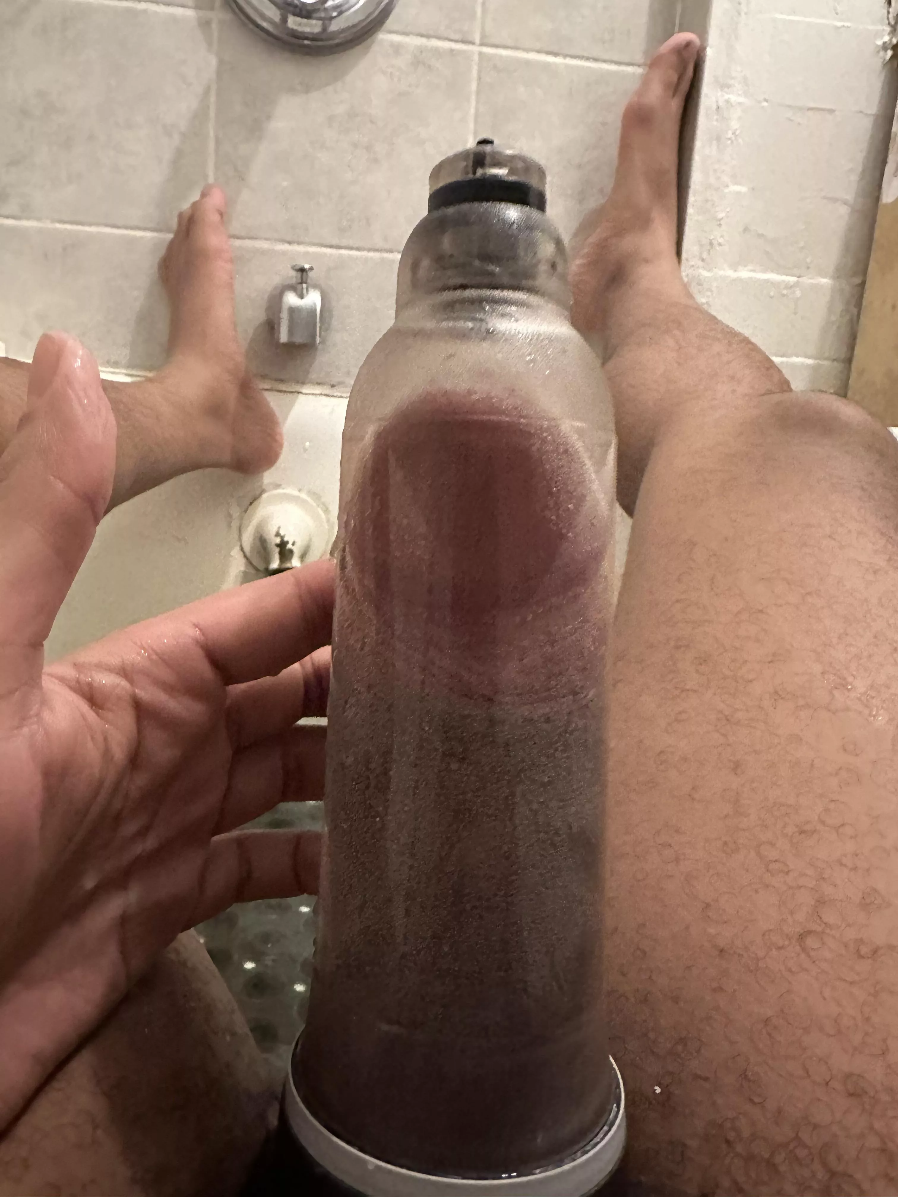 First of two 15 min sessions, minimal edema too!