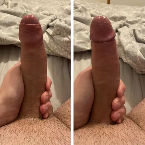 Foreskin up or down?