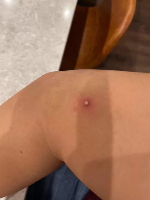 Is this a forbidden pop?