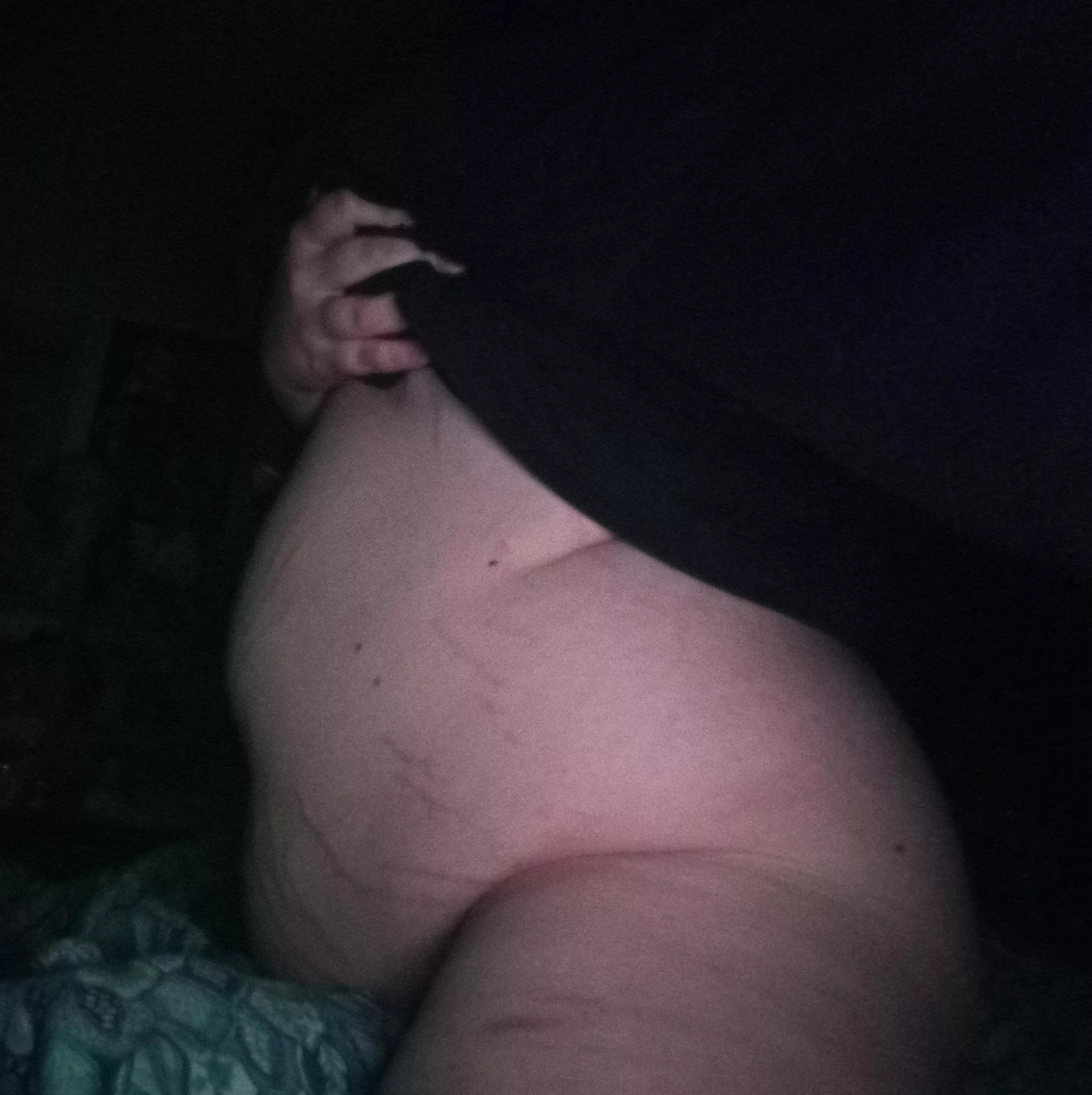 severe obesity is only 10lbs away 🥺