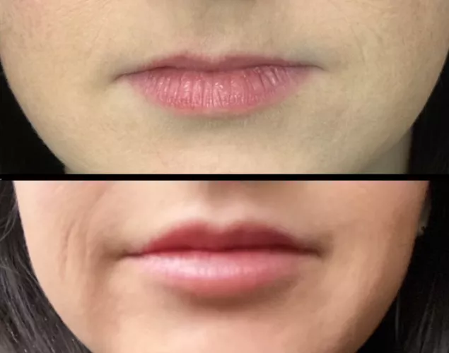 Wife's upgraded lips. What do you think?