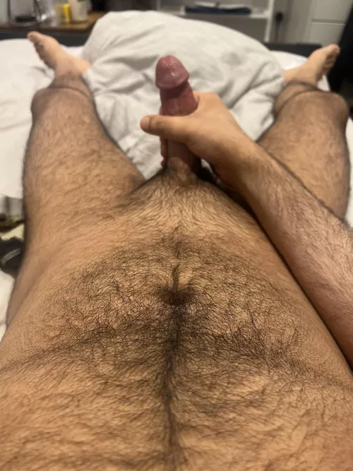 23 - got hairy like this all of a sudden, what should I expect in 5-10 years?