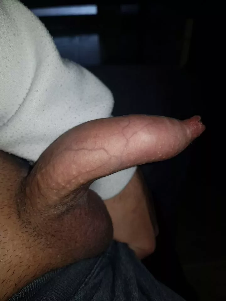 pms open