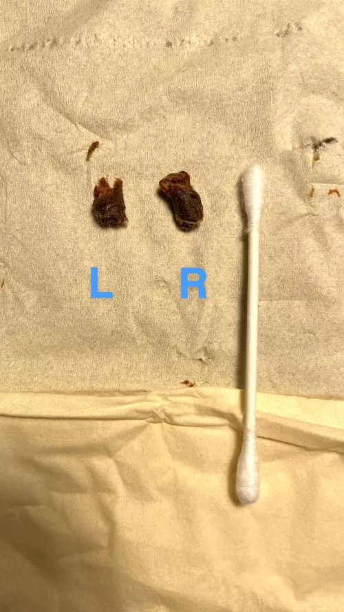 GF noticed some wax in my ear today. Turns out I’ve been wearing earplugs for years