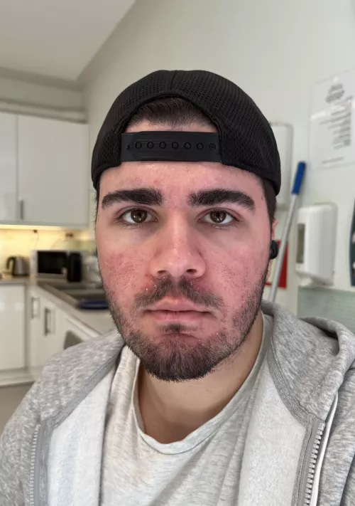 Me and my eyebrows that will soon declare independence