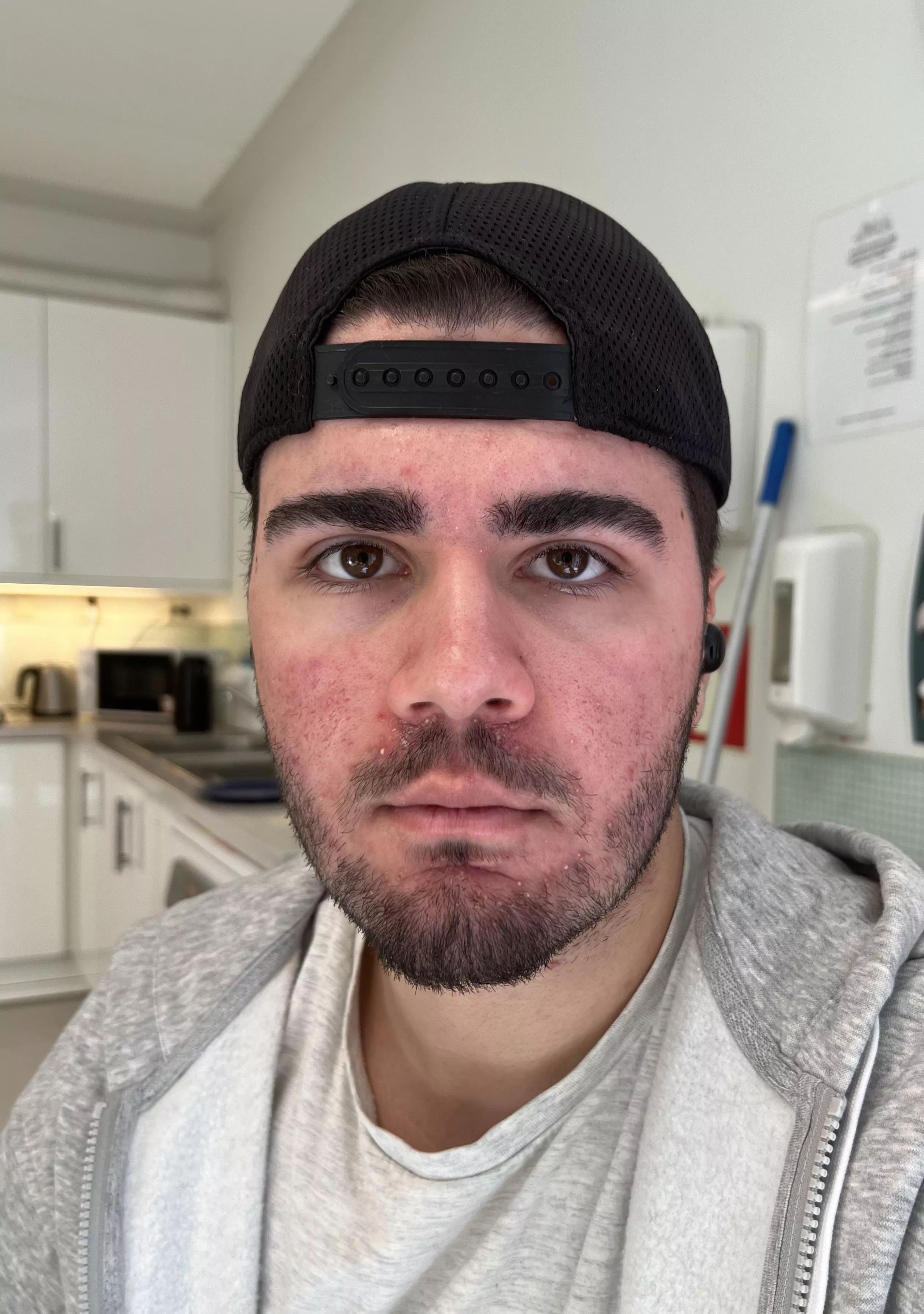 Me and my eyebrows that will soon declare independence