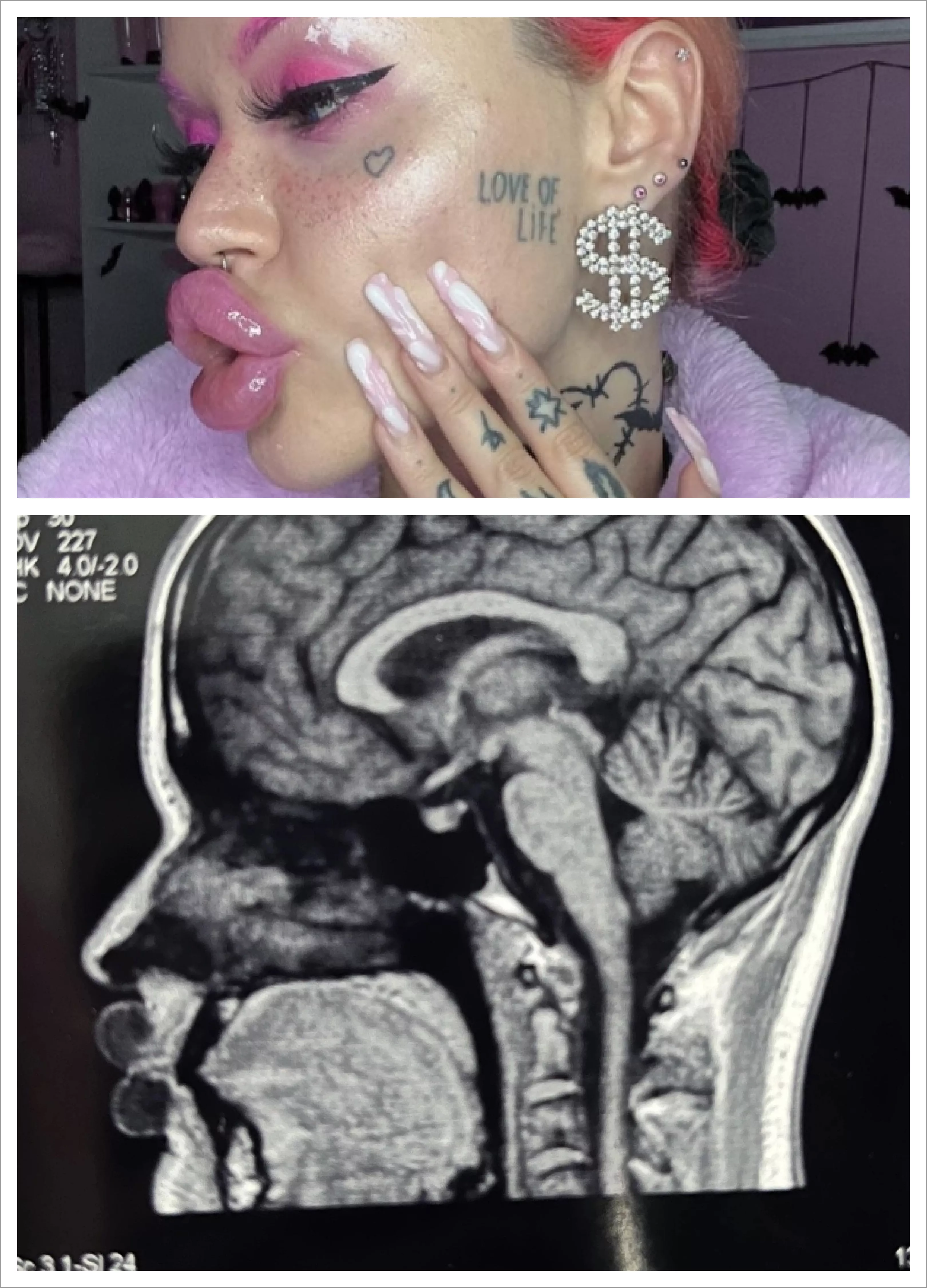 u/nasty_bimbo ducky lips X-ray