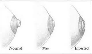 What kind of nipples do you have?