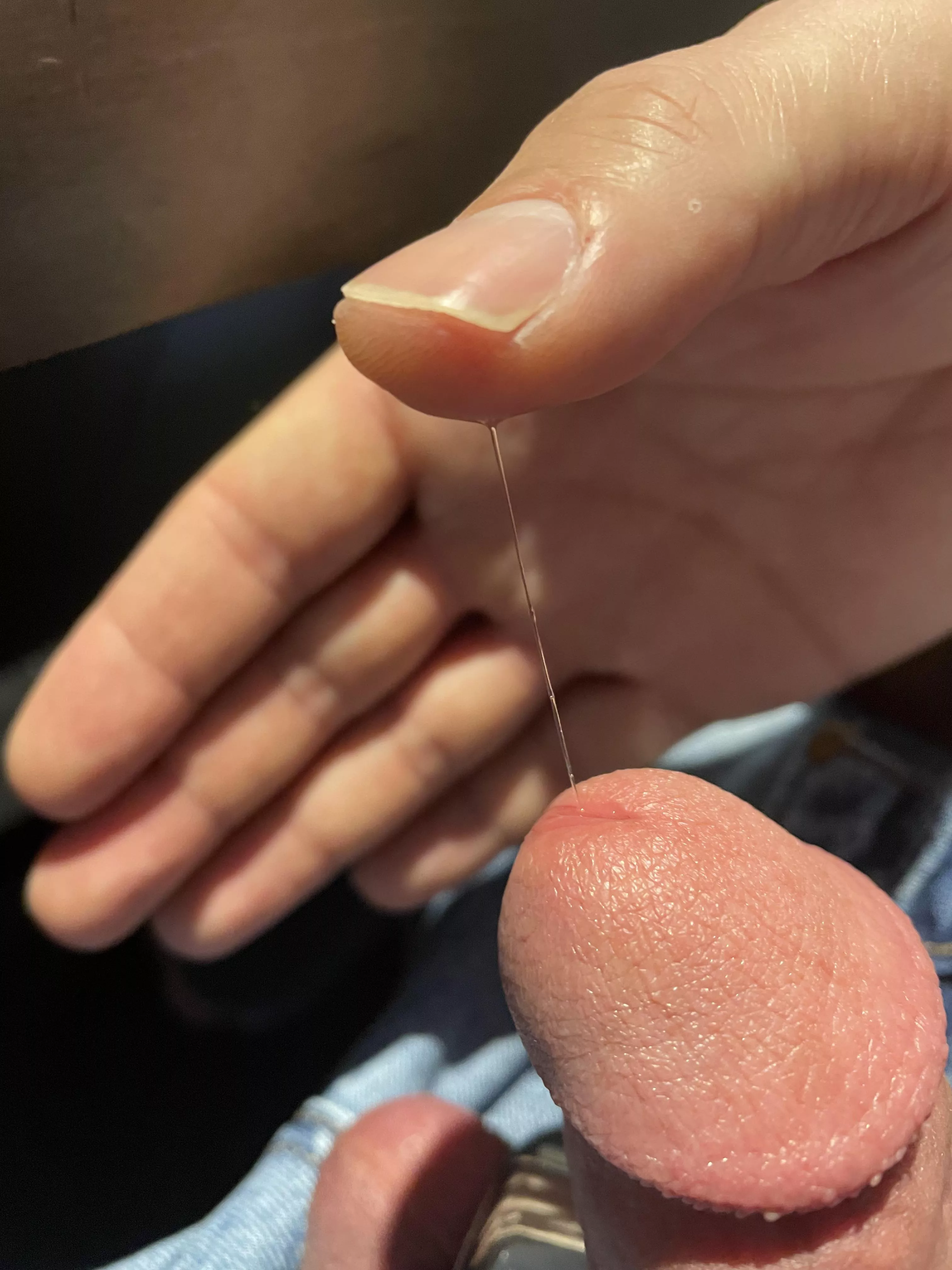 Does this look normal to you