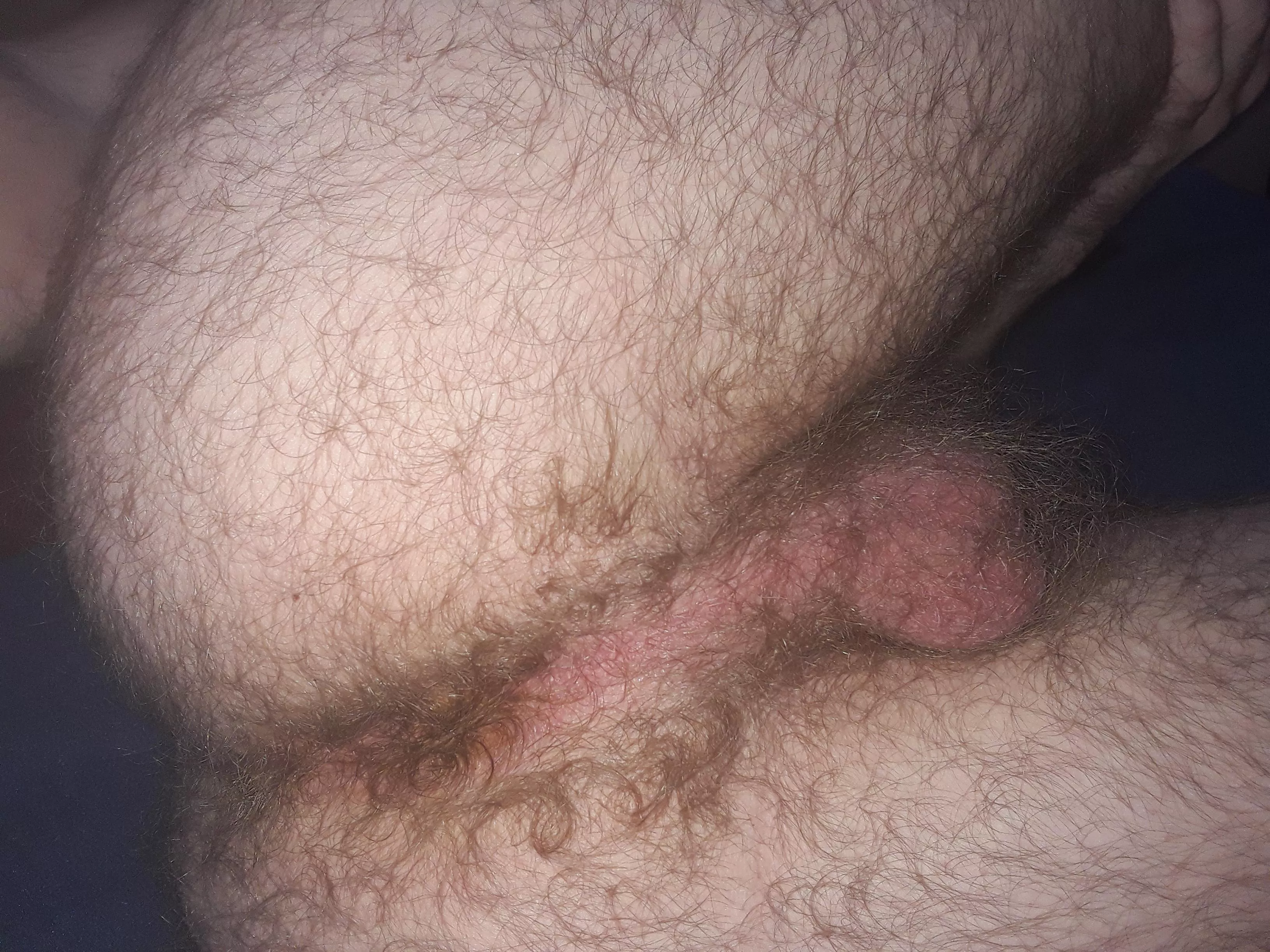 I wish I was a bit hairier