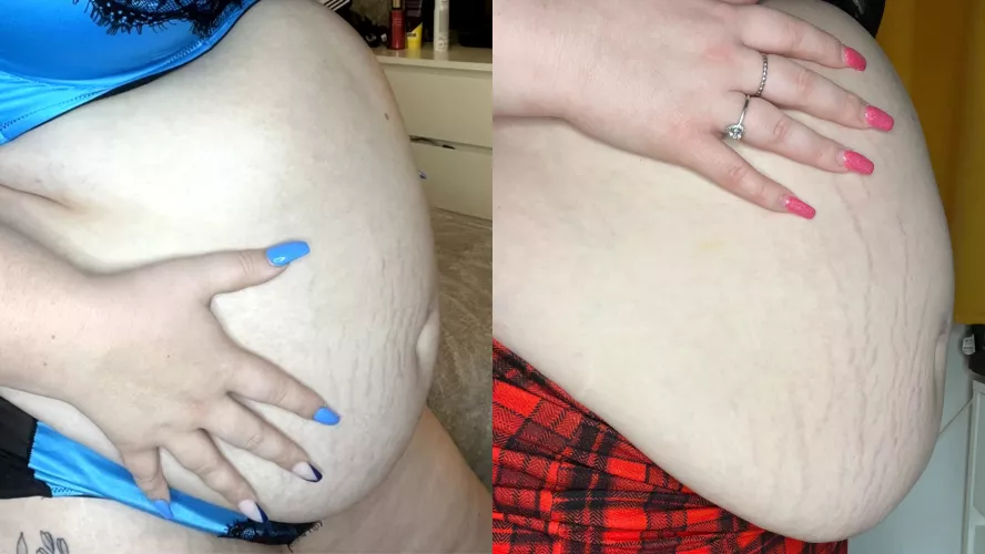 Look how many more stretch marks in the last 4 months 😮😮😮😮