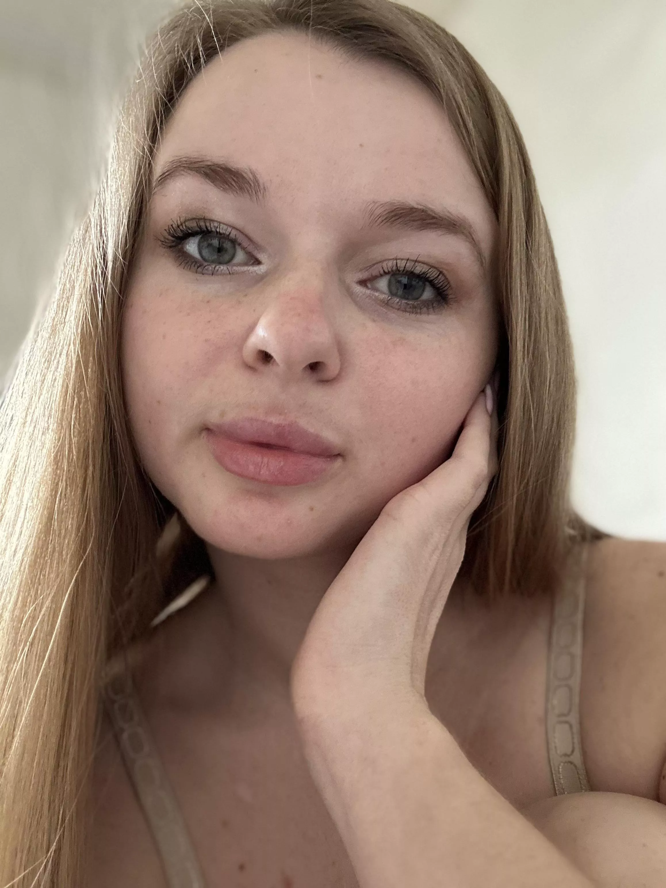 this photo shows the freckles pretty well