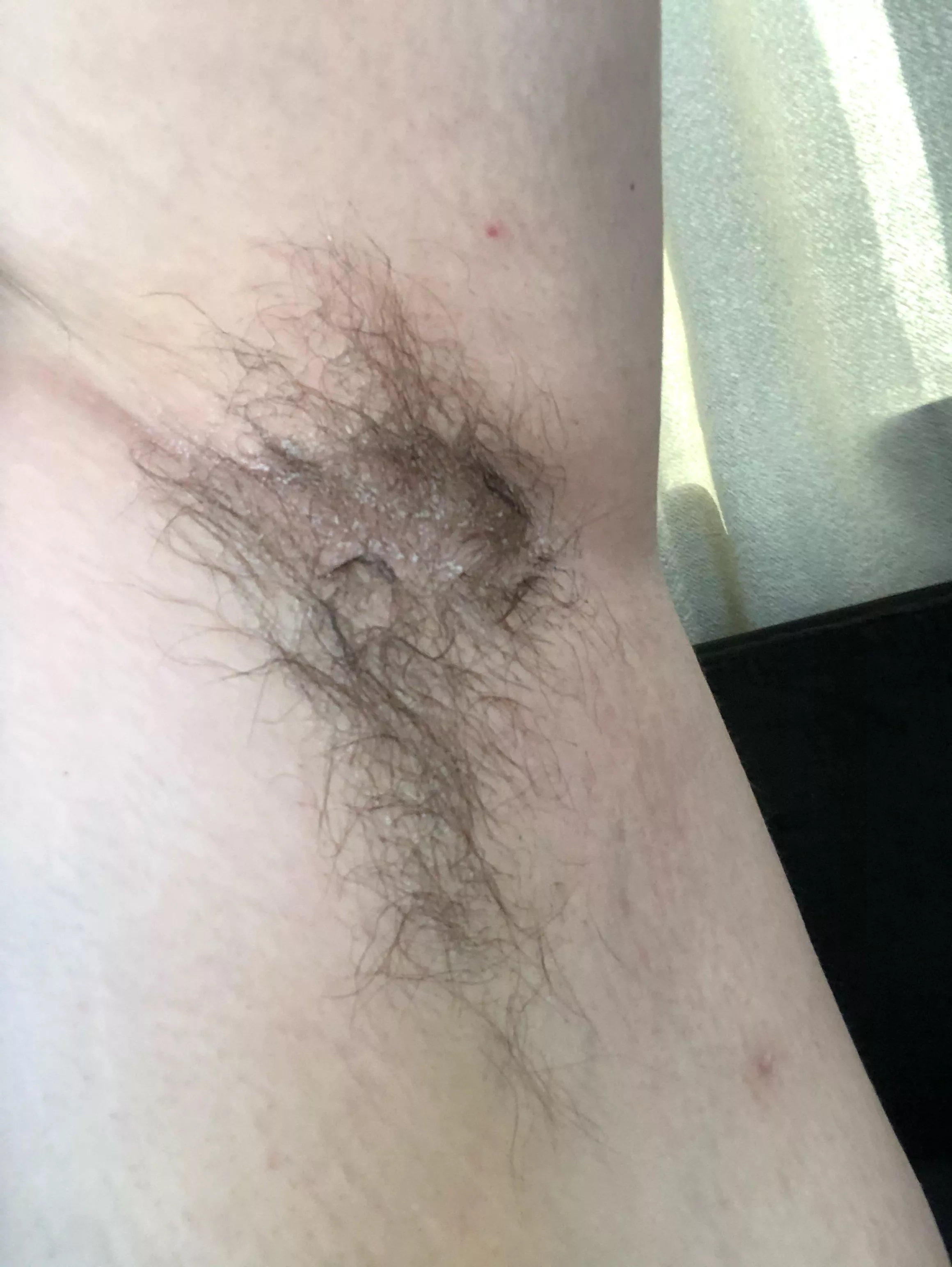 Who wants to see more? I’m hairy like this all over 22 f