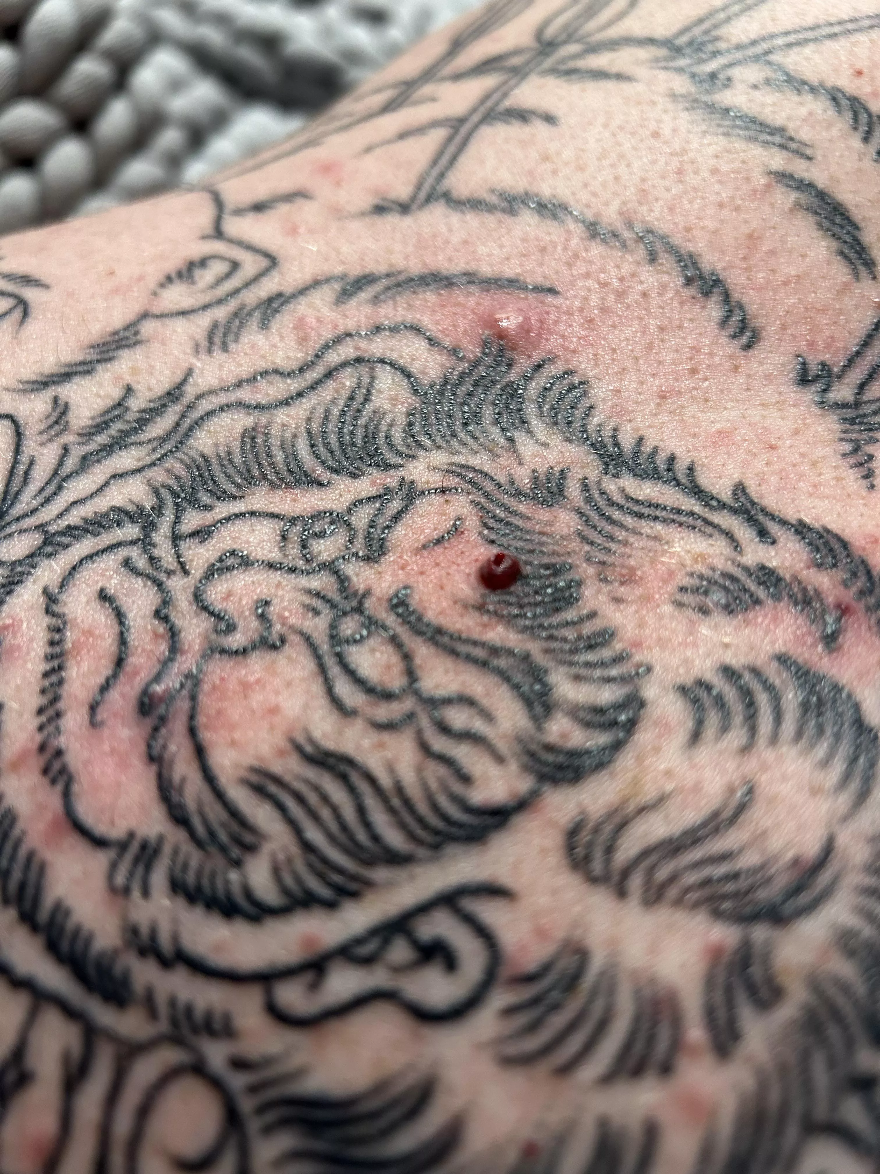 Blood blister or something else?