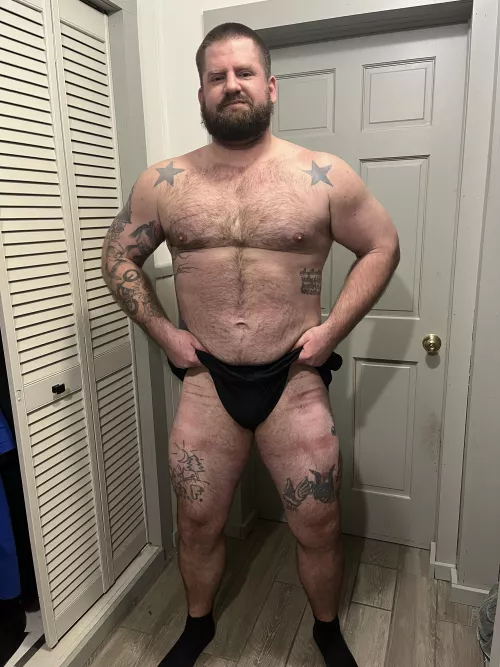 Bruises looking like tiger stripes