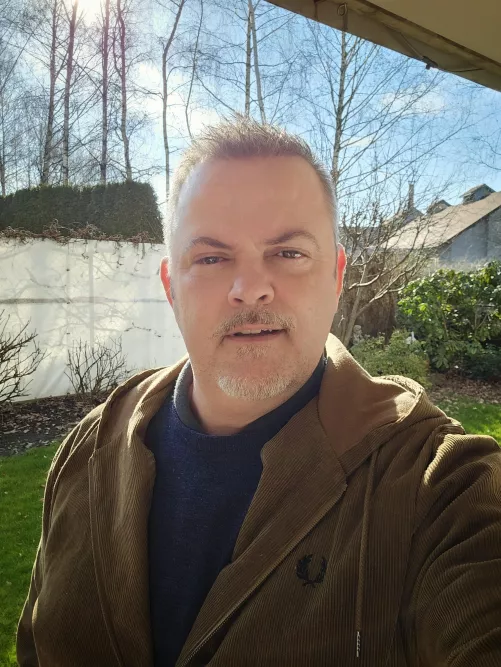 My eye is slowly getting better🙂