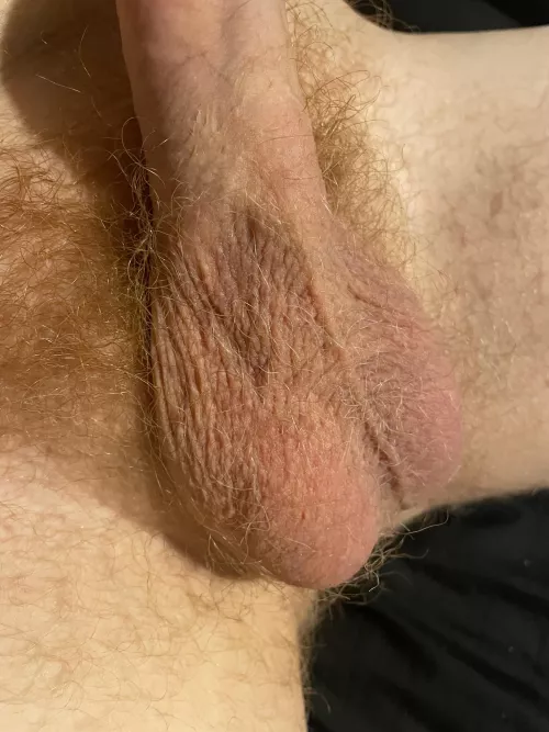 30 year old hairy ginger balls