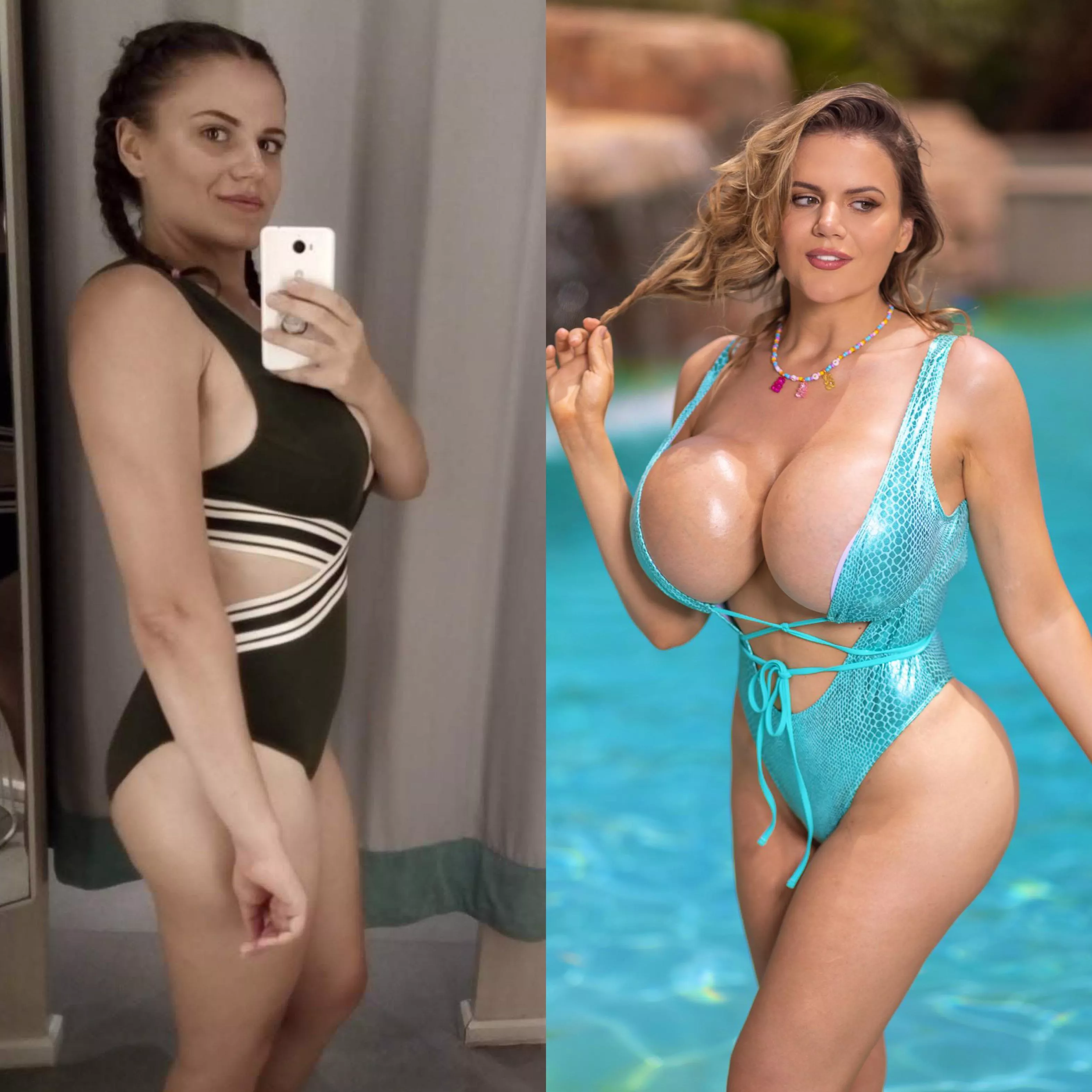After I lost 70 pounds of fat, I put on 20 pounds of plastic [oc]