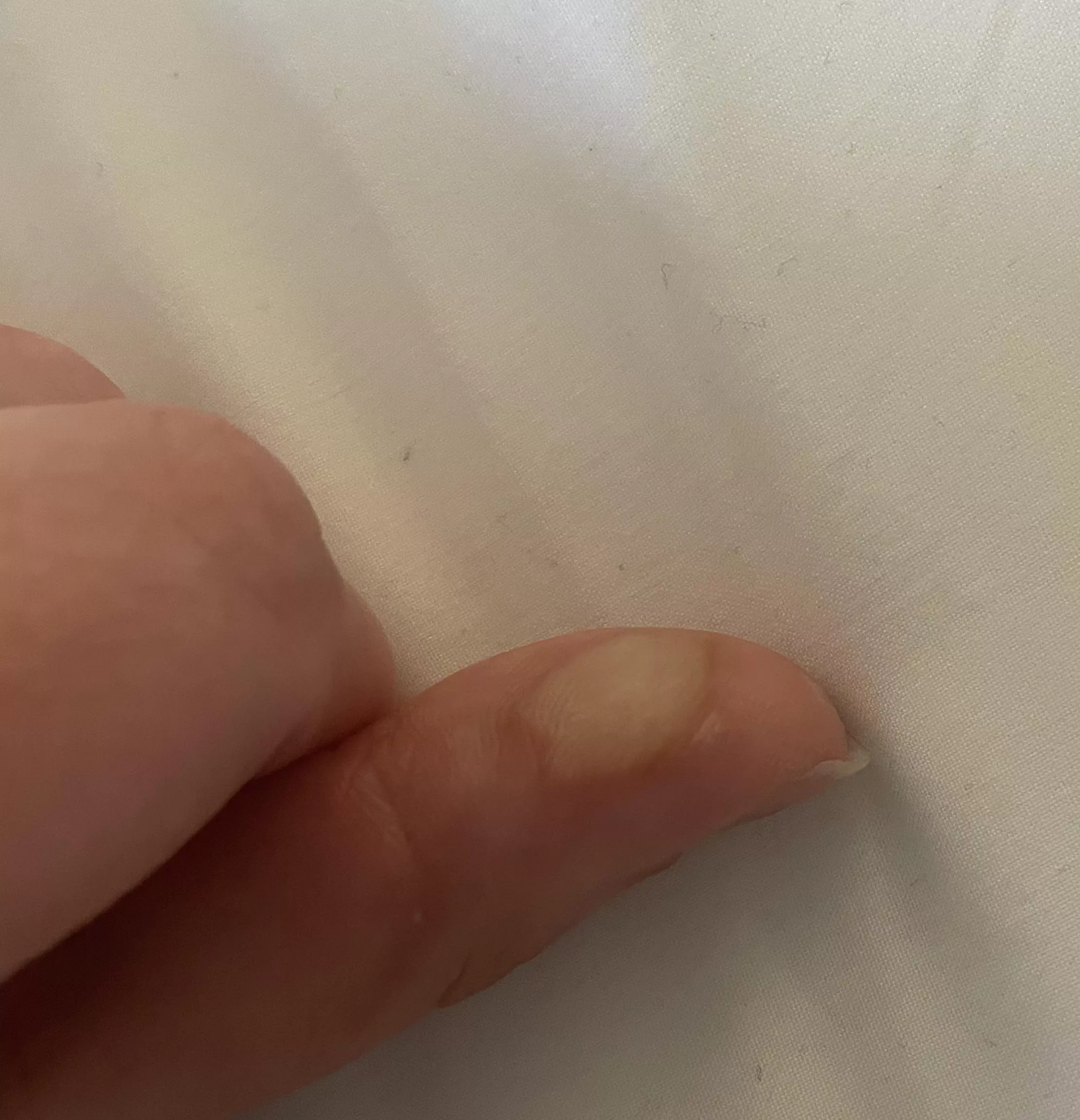 Forbidden, deep burn blister