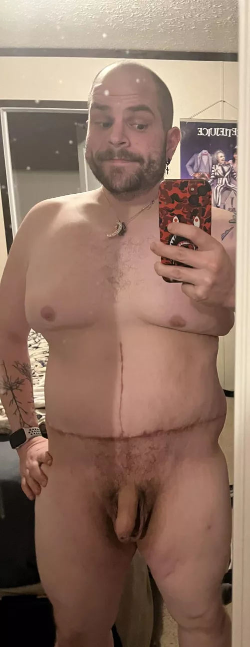 (M) 30 this is my first full nude since loosing a lot of weight and skin removal. Be fair how do I look?
