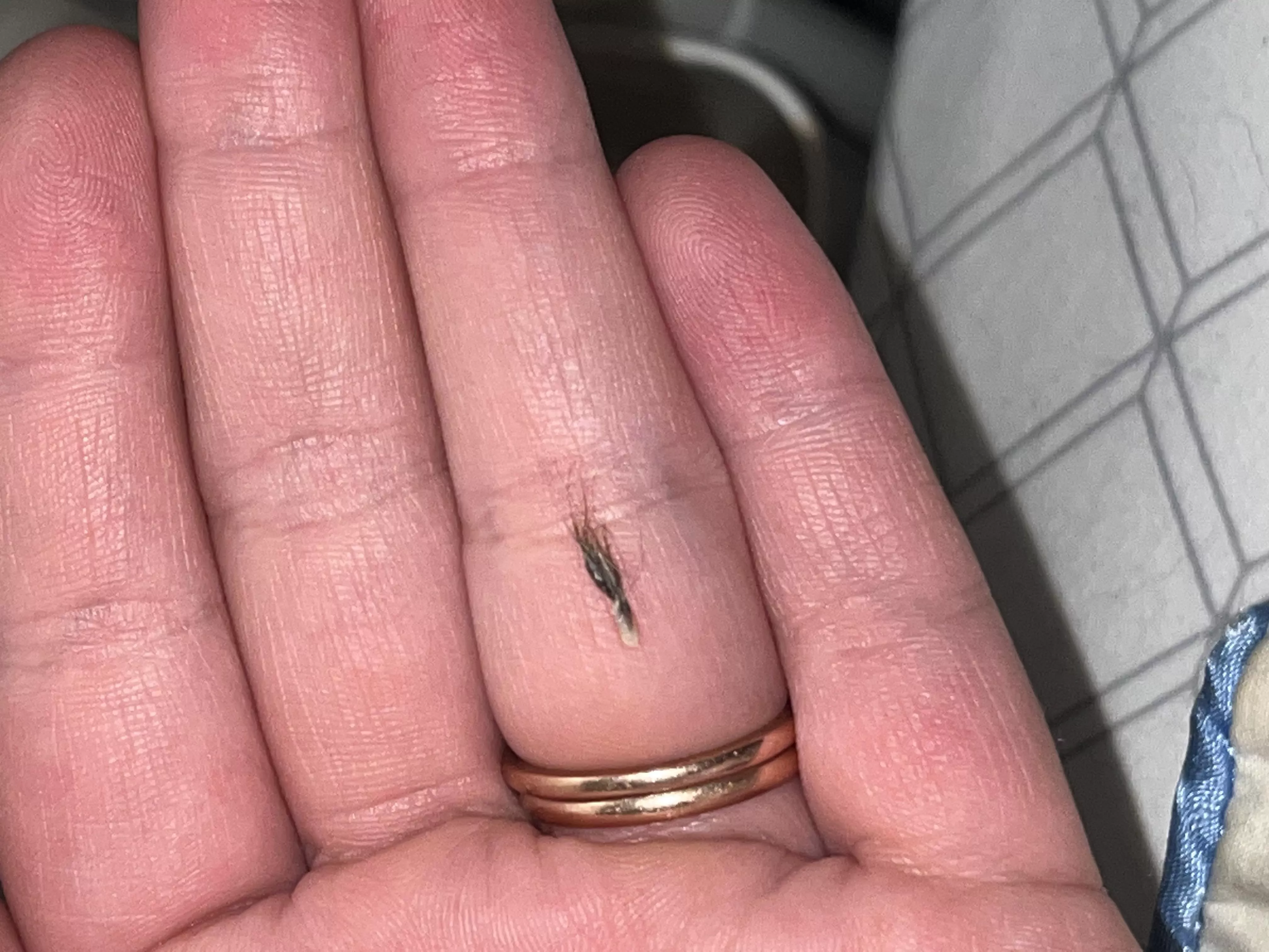 Not a pop, but this came out of my husbands belly button.