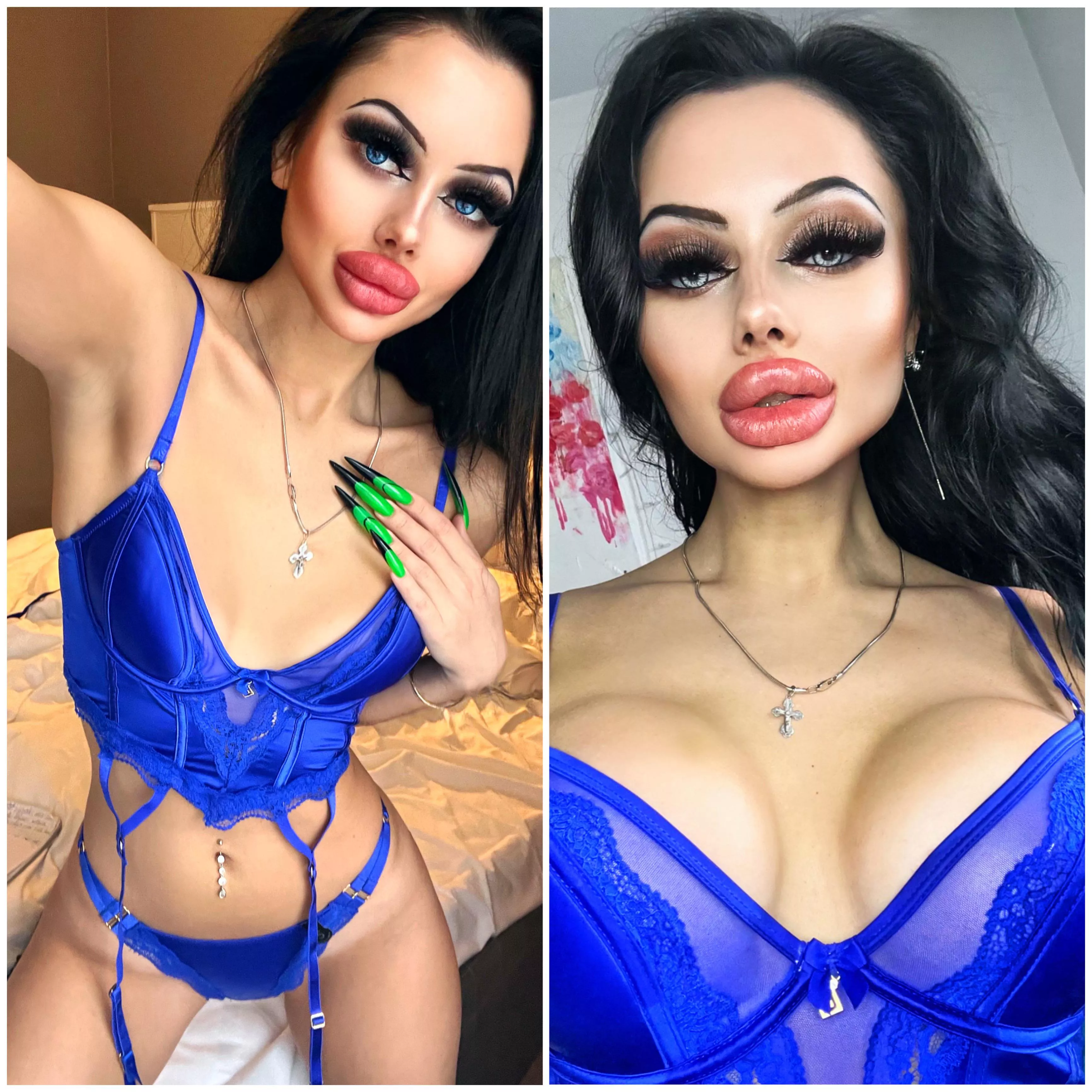 Showing my new boobs for the first time since surgery