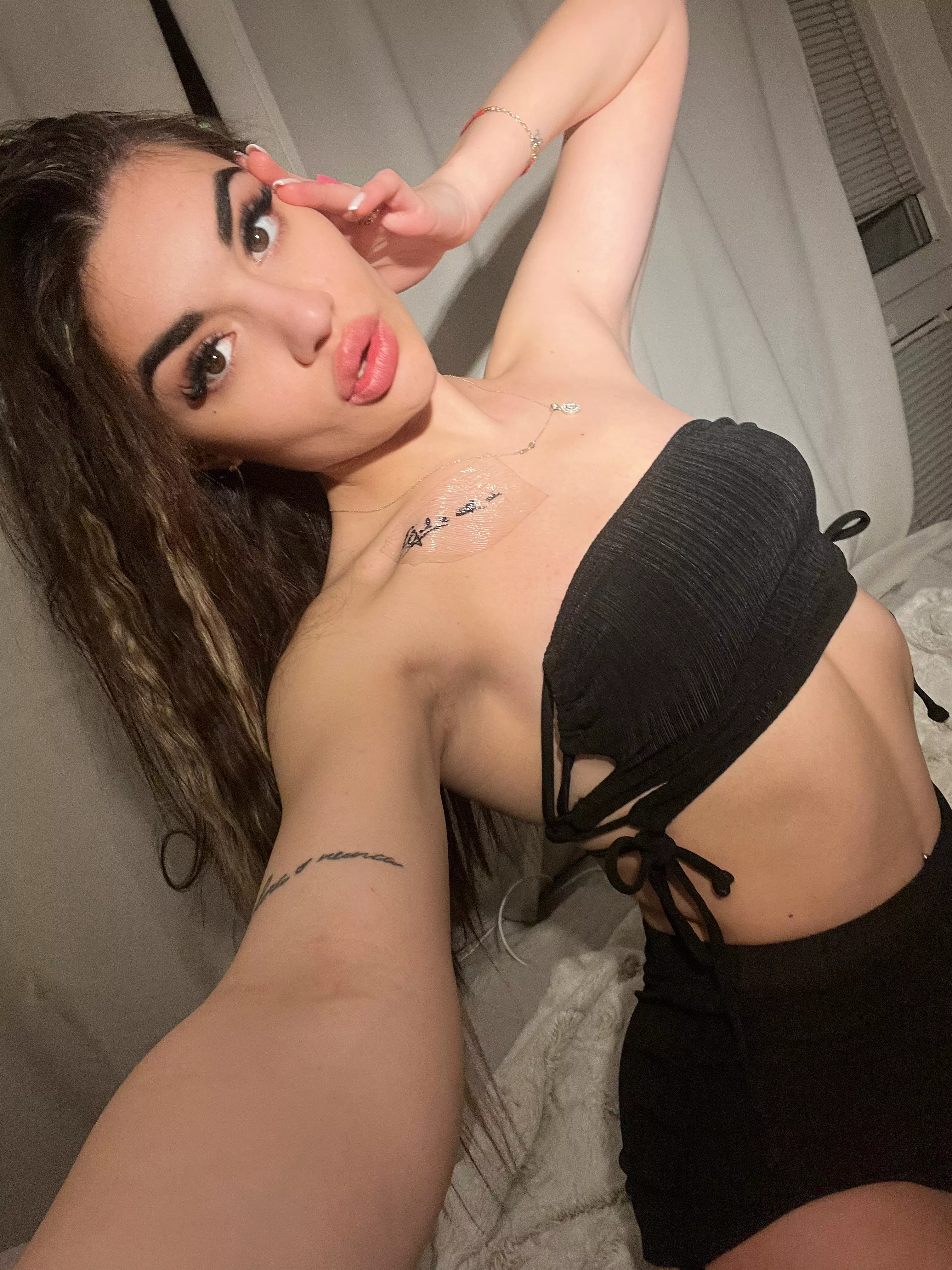 Burning from hotness