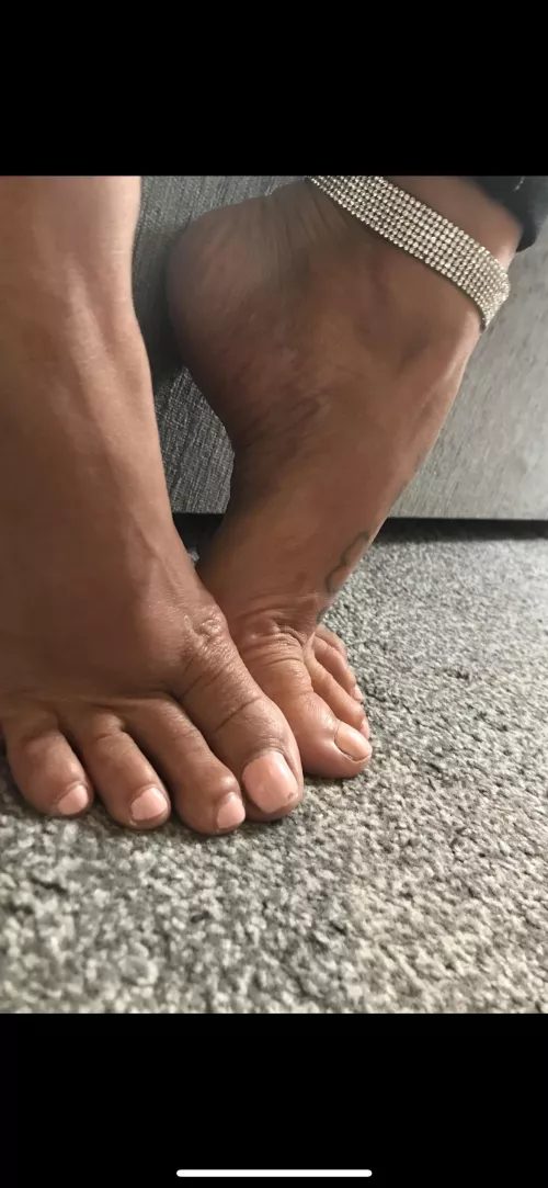 My wrinkled arches
