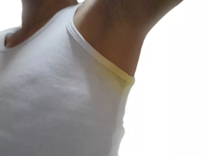 My Armpits with Yellowish Sweat Stains😔(share your thoughts about it)