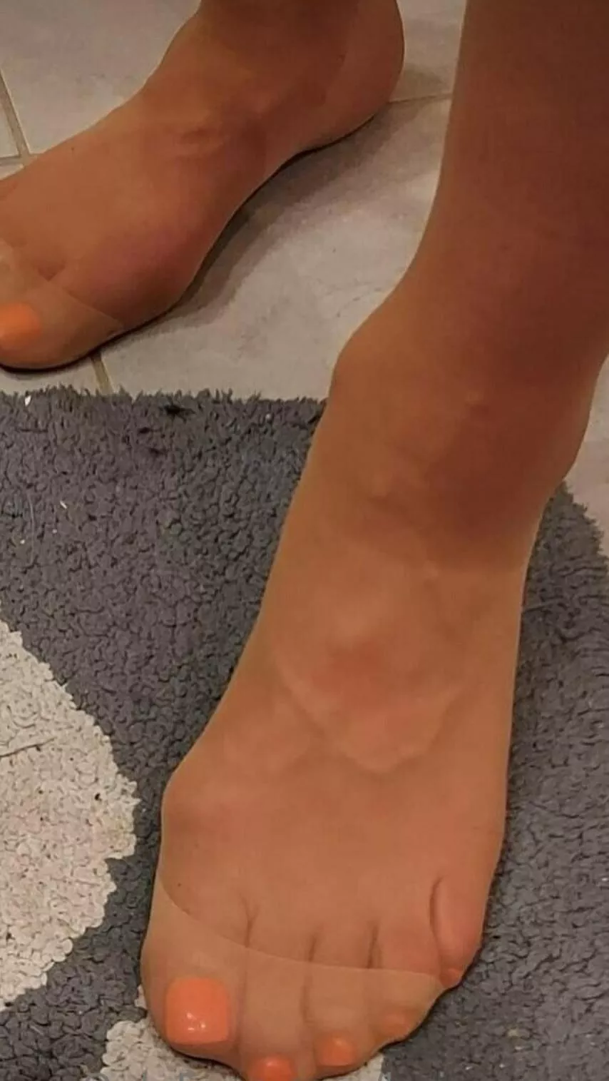 orange nails and hose