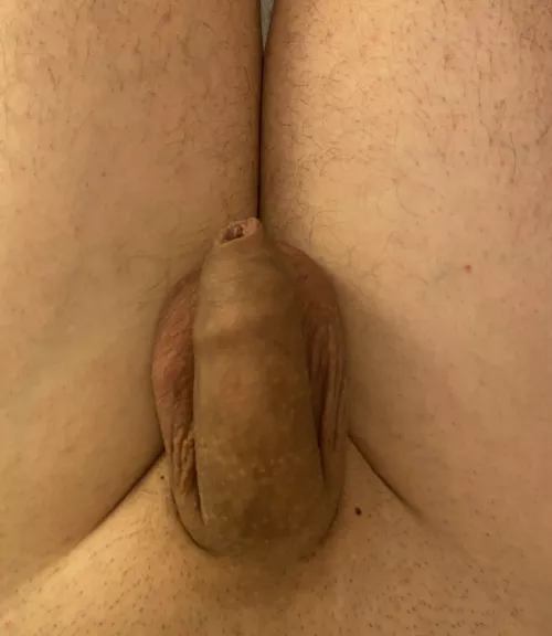 Soft penis and soft scrotum.