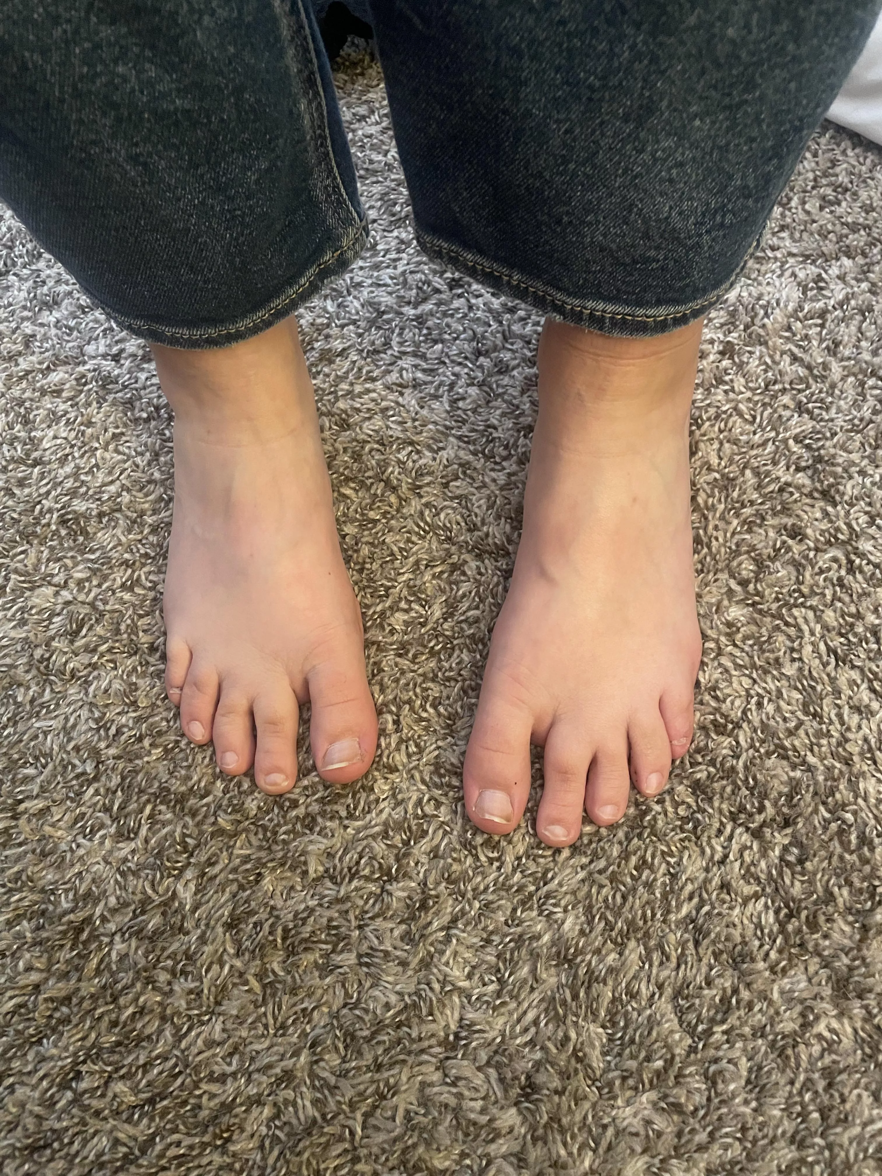 They're so sore from walking all day 😩