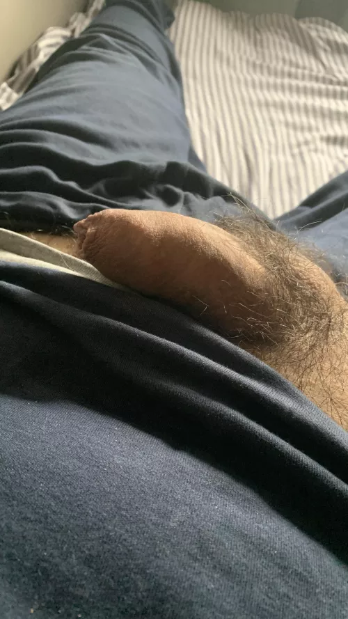 An hairy softy in the sun