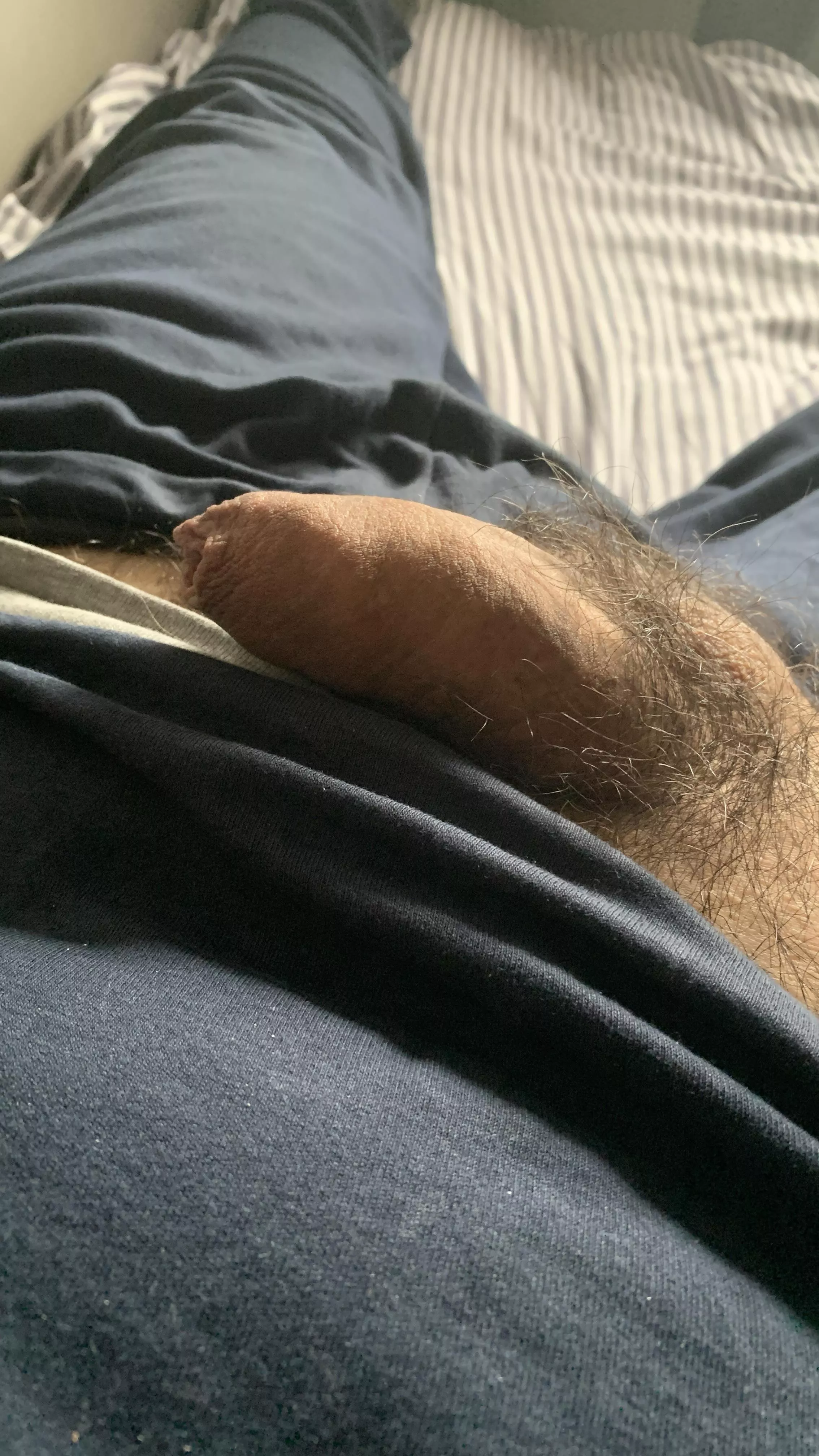 An hairy softy in the sun