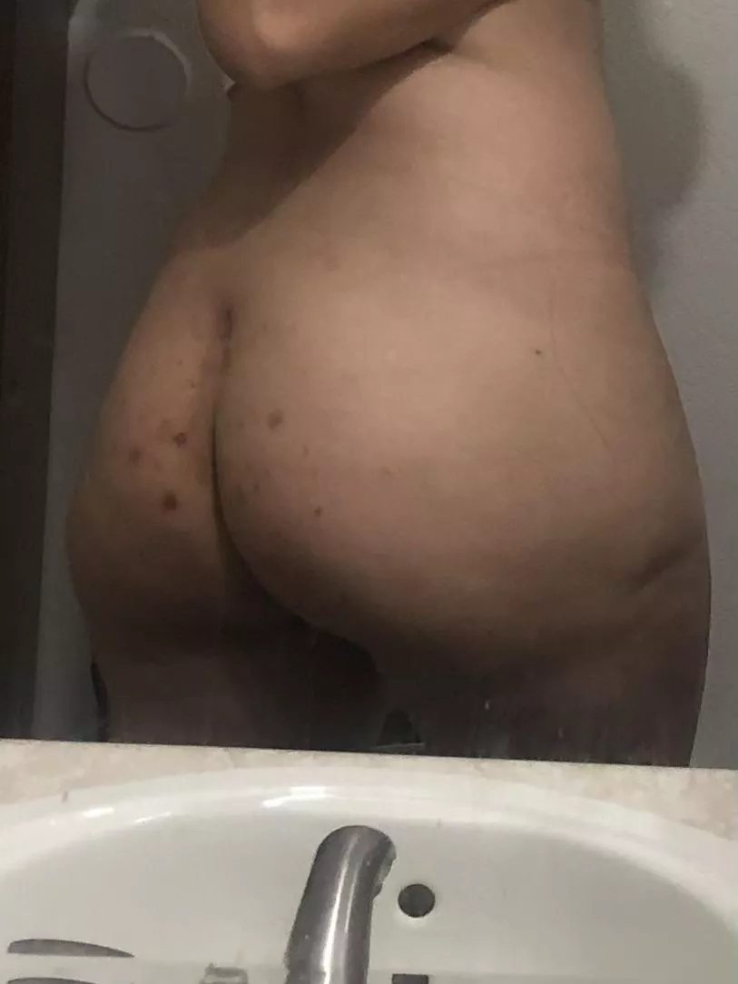 Anyone else’s booty look like this? :/