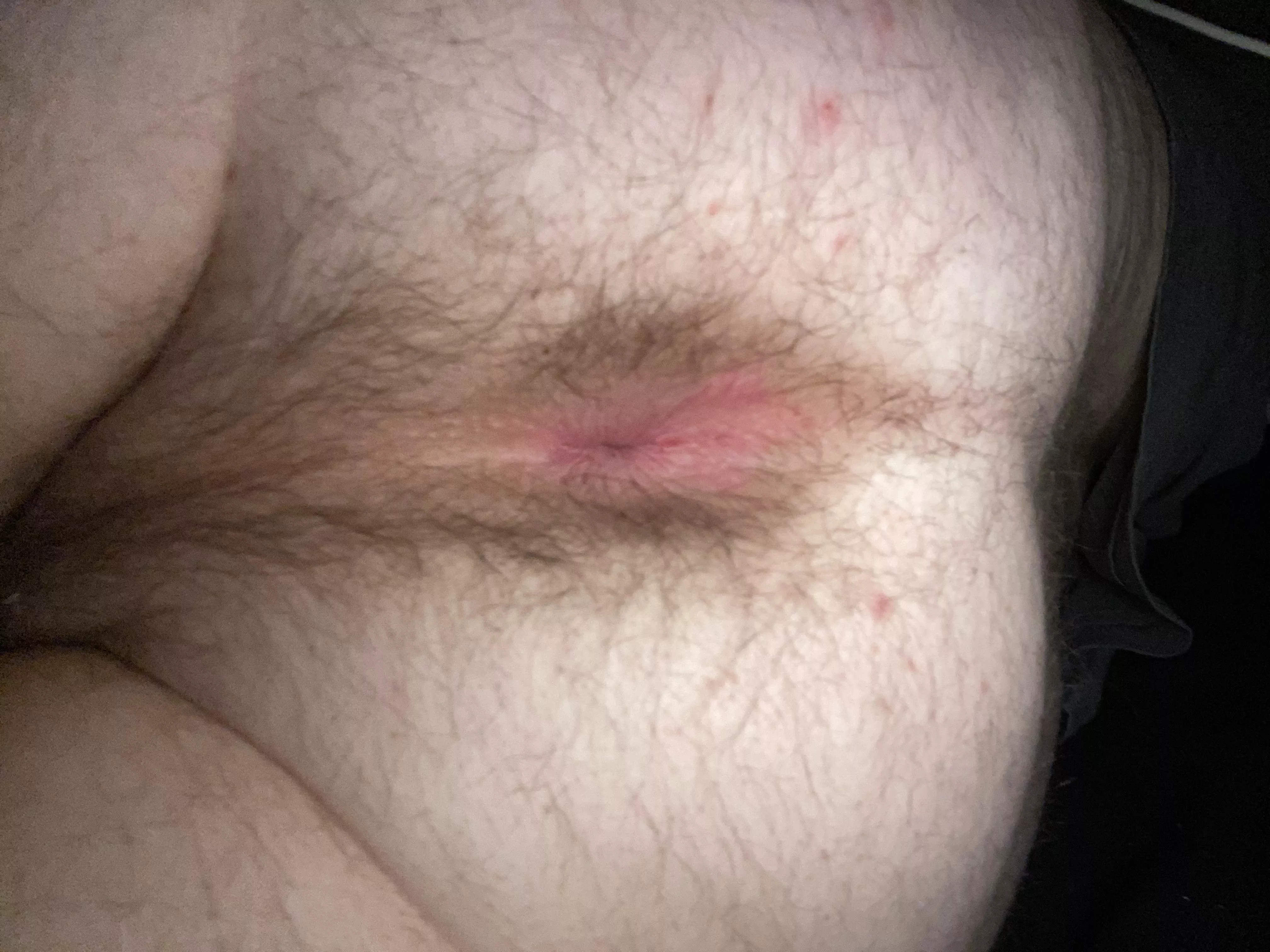 do you guys like pink holes?