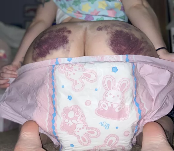 Bunny friends to hide the bruises 🤭