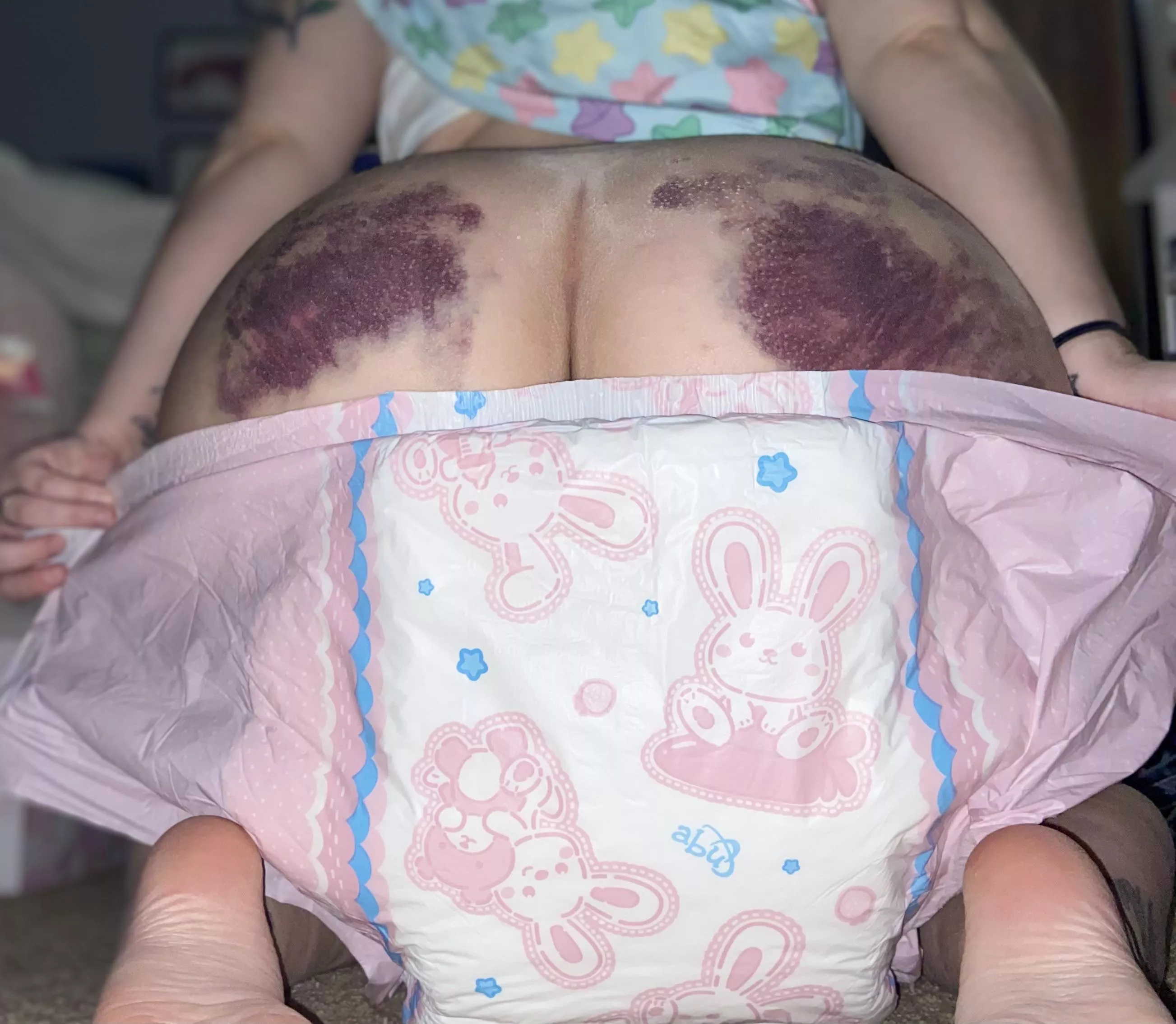 Bunny friends to hide the bruises 🤭