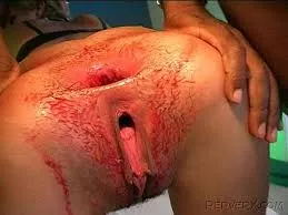 Dumb Bitch Tracey Laforet Got Gangbanged And Donkey Punched In The Dark Lol ( Not By Me )