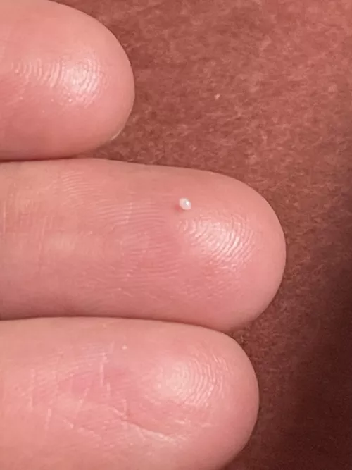 A shiny little skin pearl