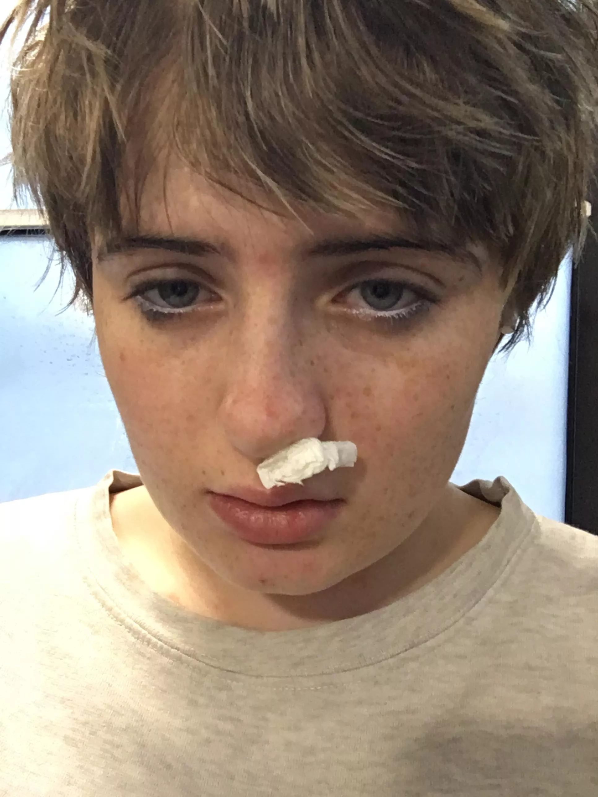 My nose is bleeding :(( f18