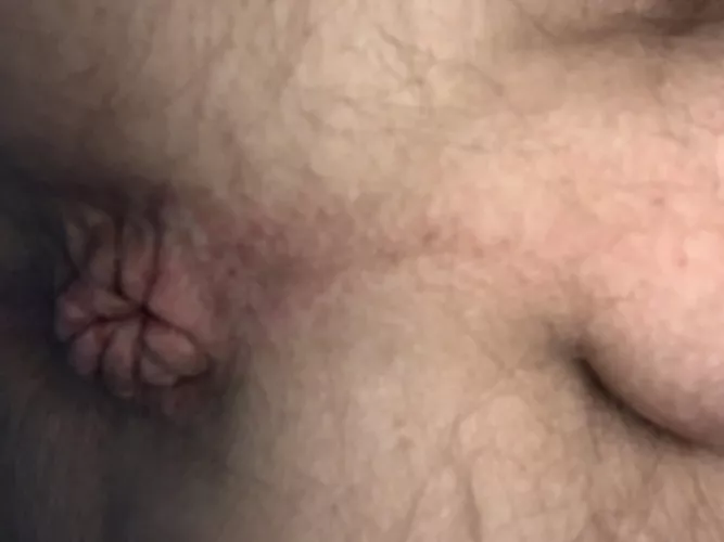 Now this is a busted hole! Does anyone find it attractive?