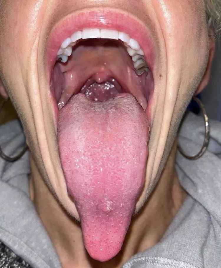 Spitty at the back aha [OC]