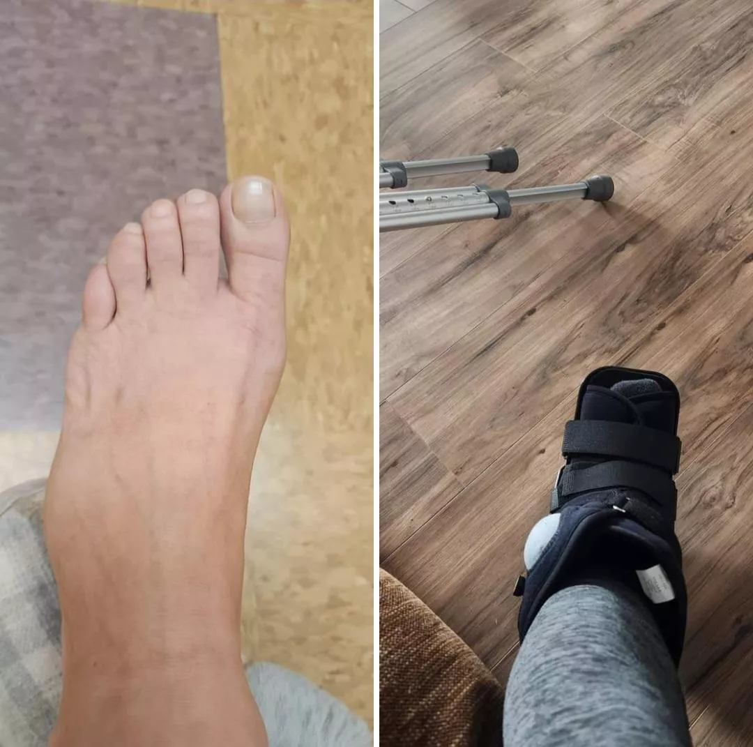 Unfortunately this girl won't be working out for awhile