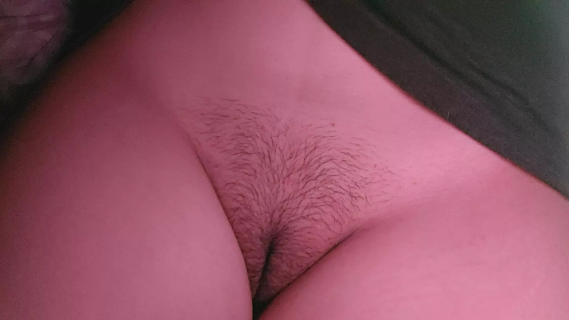 god made me so perfect that of this growth resembles a heart